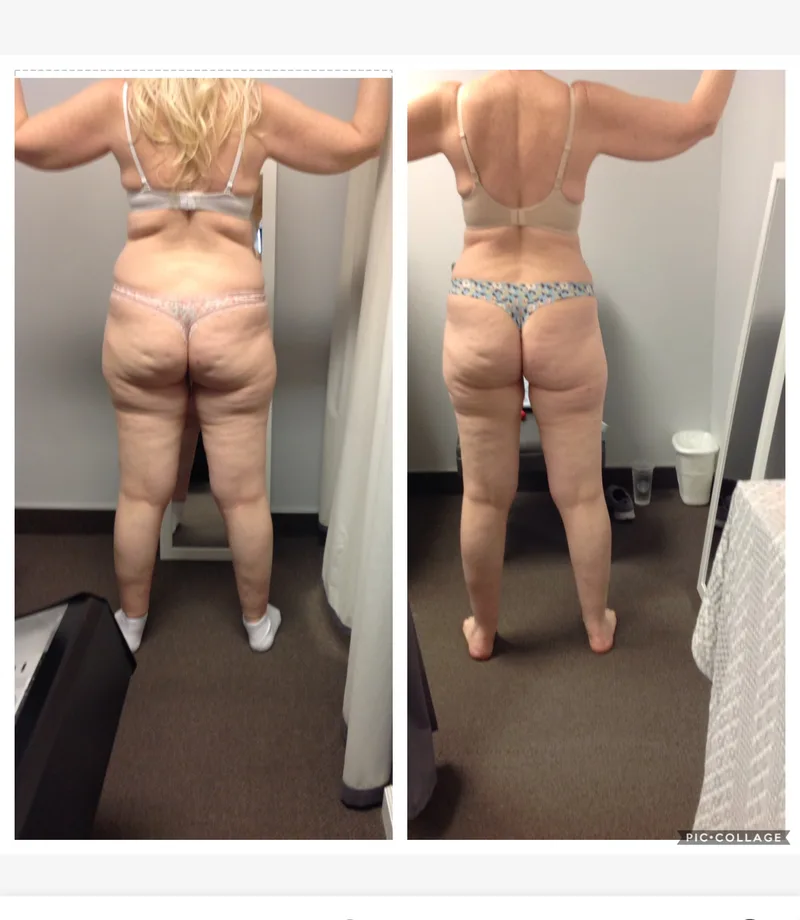 Penny Foskaris Wellness | Before & After Photos