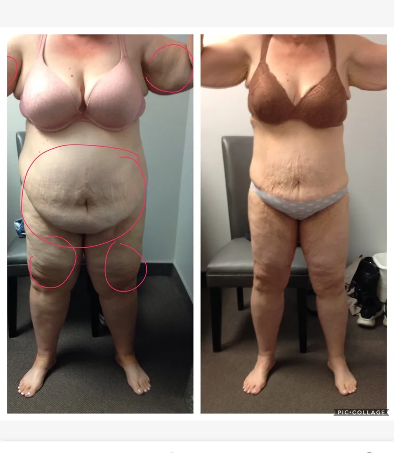 Penny Foskaris Wellness | Before & After Photos