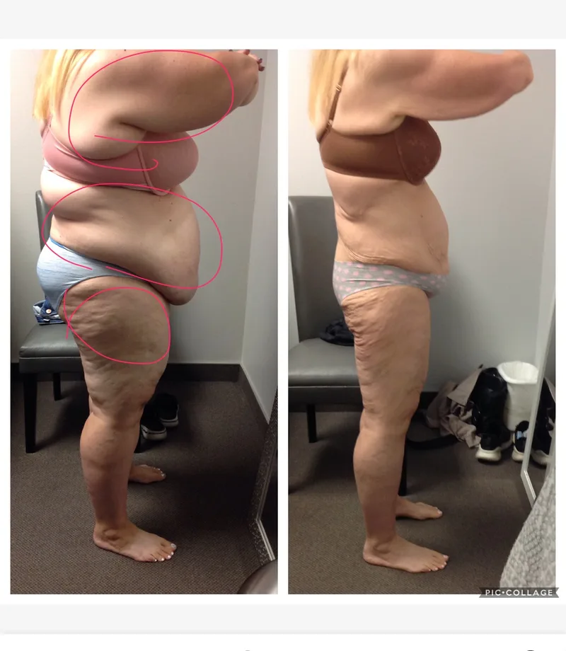 Penny Foskaris Wellness | Before & After Photos