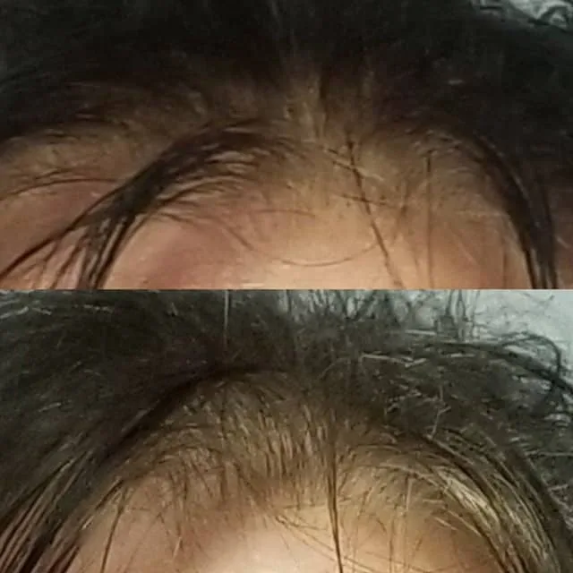 Penny Foskaris Wellness | Before & After Photos