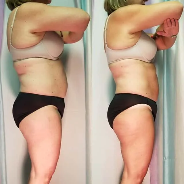 Penny Foskaris Wellness | Before & After Photos