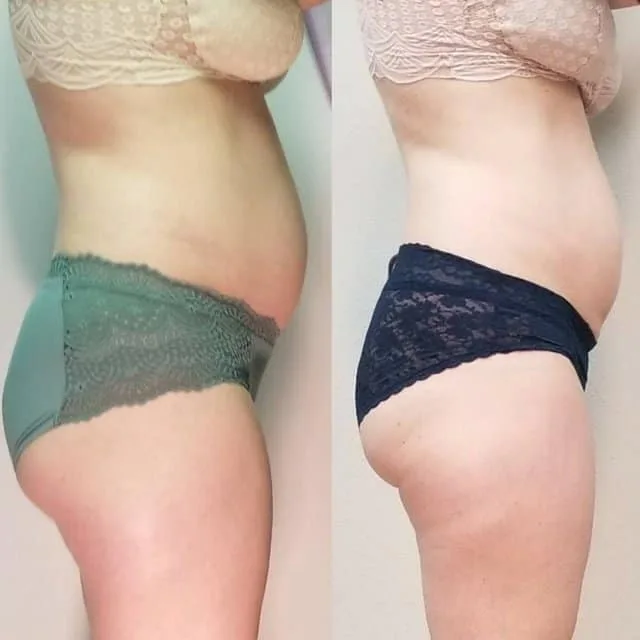 Penny Foskaris Wellness | Before & After Photos