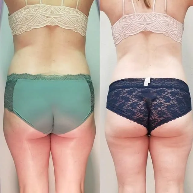 Penny Foskaris Wellness | Before & After Photos