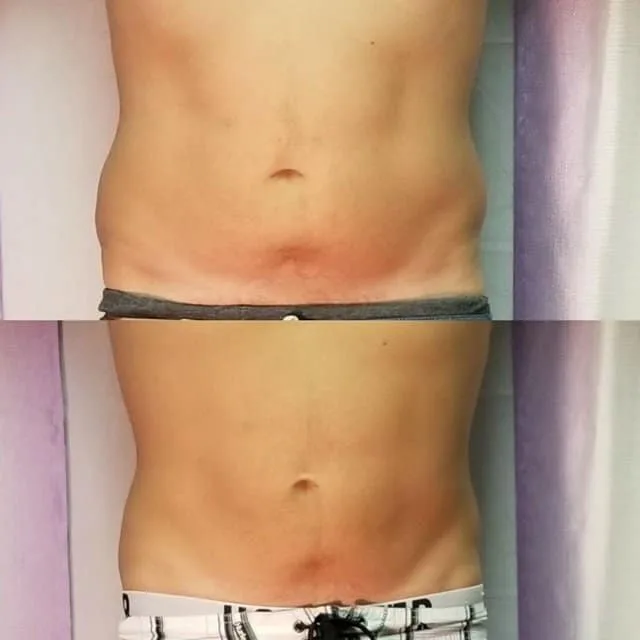 Penny Foskaris Wellness | Before & After Photos