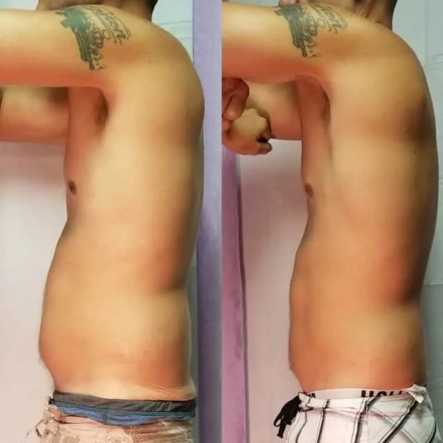 Penny Foskaris Wellness | Before & After Photos