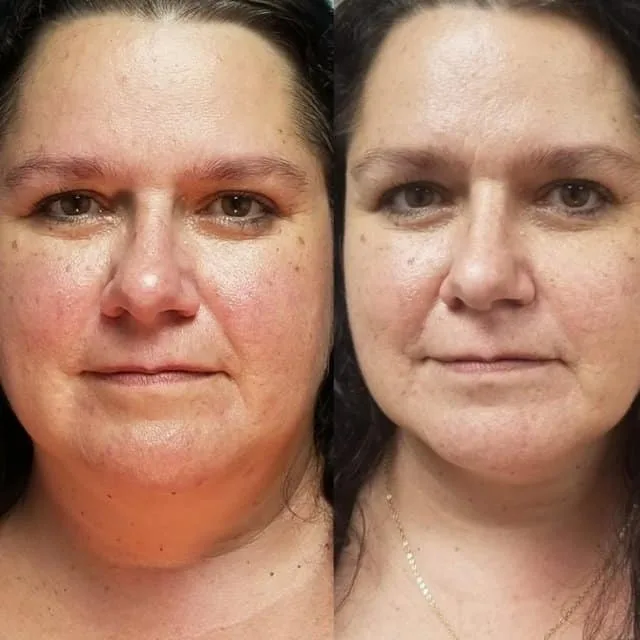 Penny Foskaris Wellness | Before & After Photos