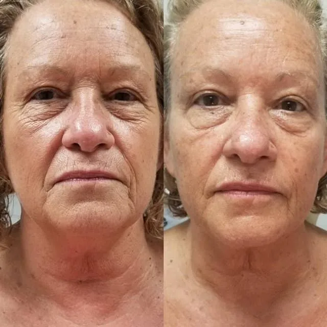 Penny Foskaris Wellness | Before & After Photos