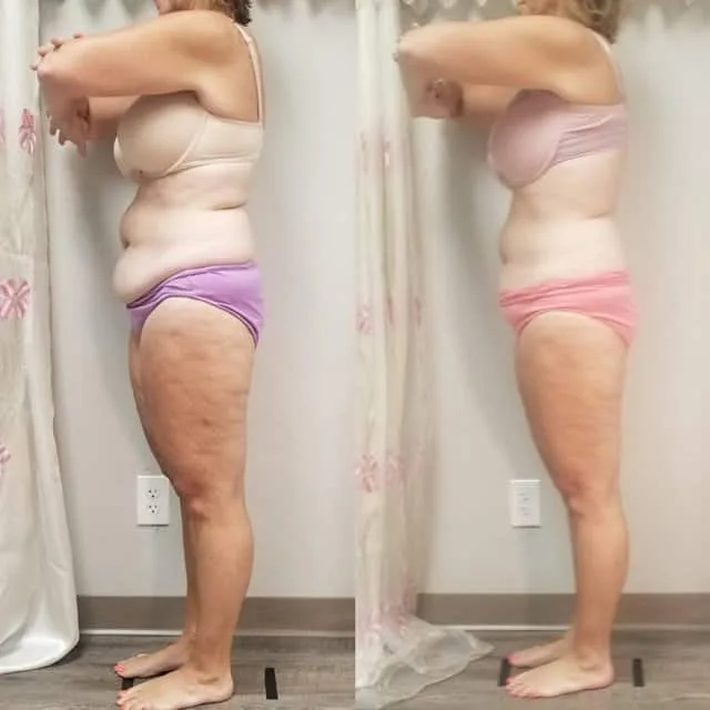 Penny Foskaris Wellness | Before & After Photos
