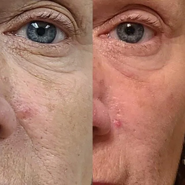 Penny Foskaris Wellness | Before & After Photos