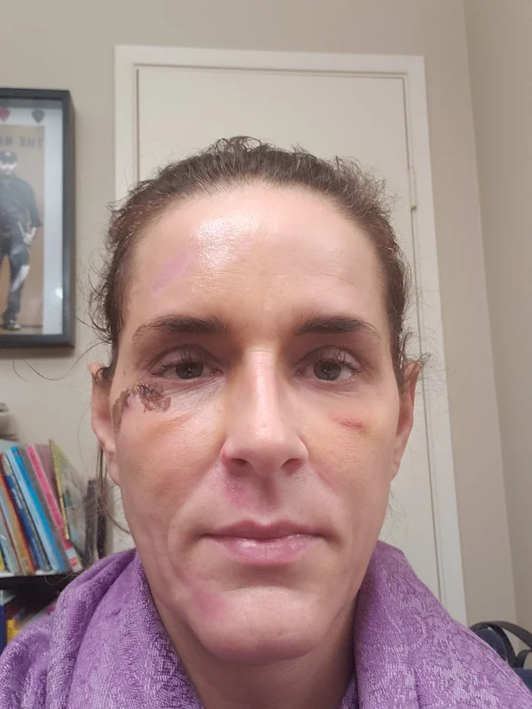 Penny Foskaris Wellness | Before & After Photos