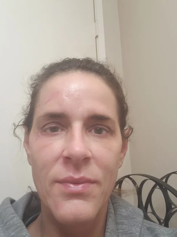 Penny Foskaris Wellness | Before & After Photos
