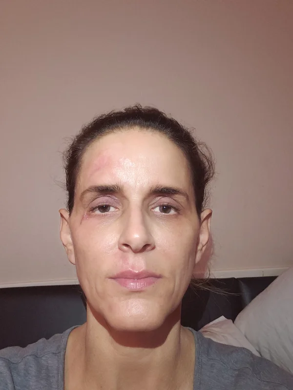 Penny Foskaris Wellness | Before & After Photos