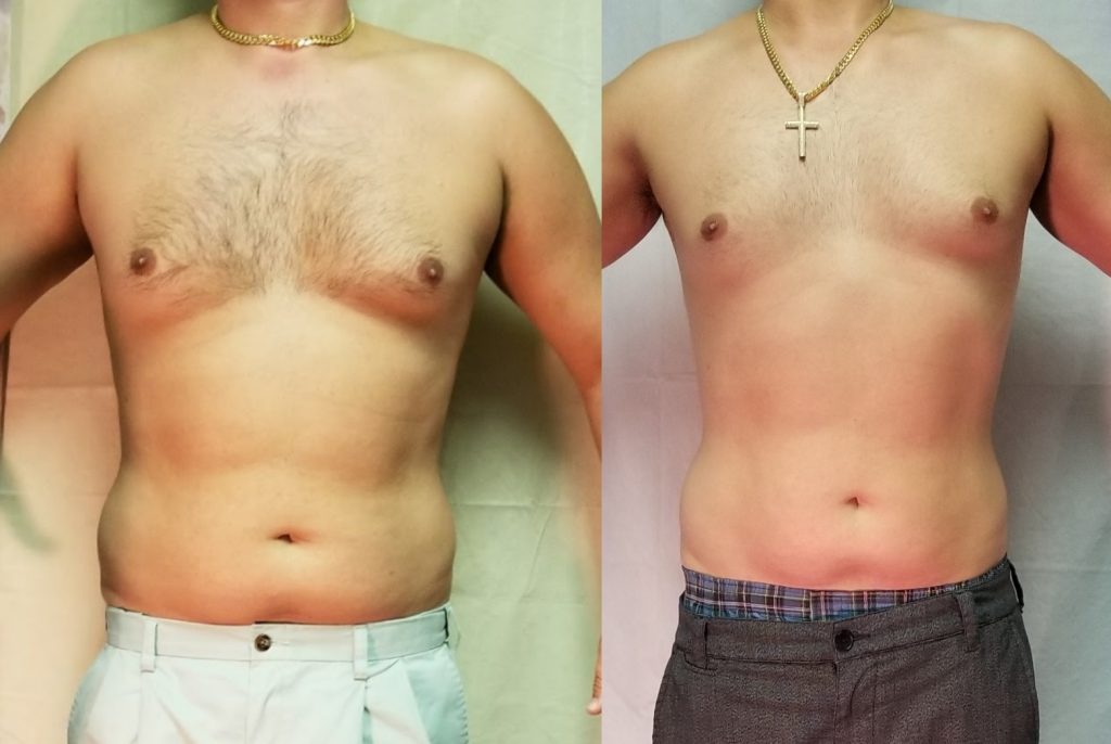 Penny Foskaris Wellness | Before & After Photos