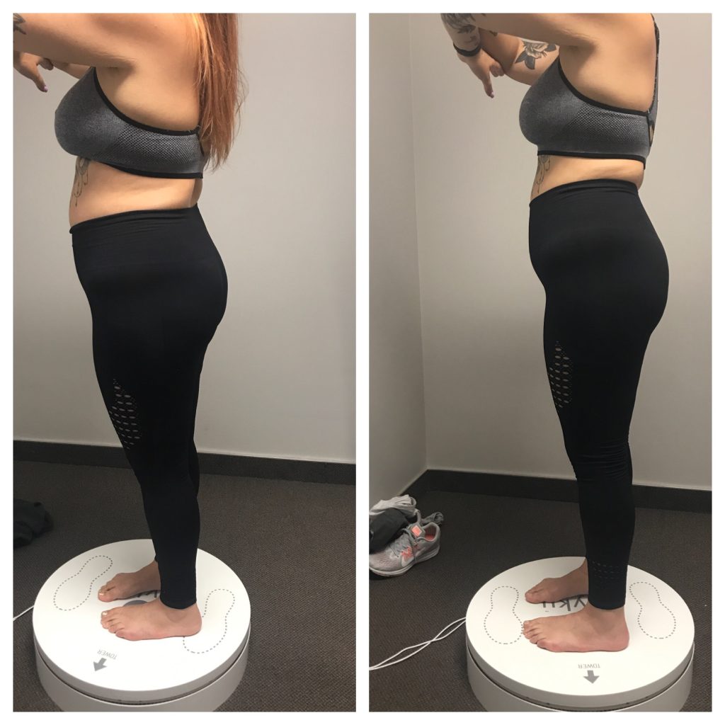 Penny Foskaris Wellness | Before & After Photos