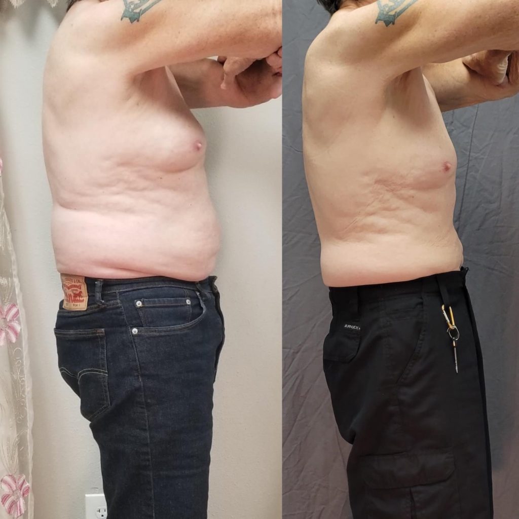 Penny Foskaris Wellness | Before & After Photos
