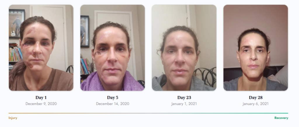 Penny Foskaris Wellness | Before & After Photos