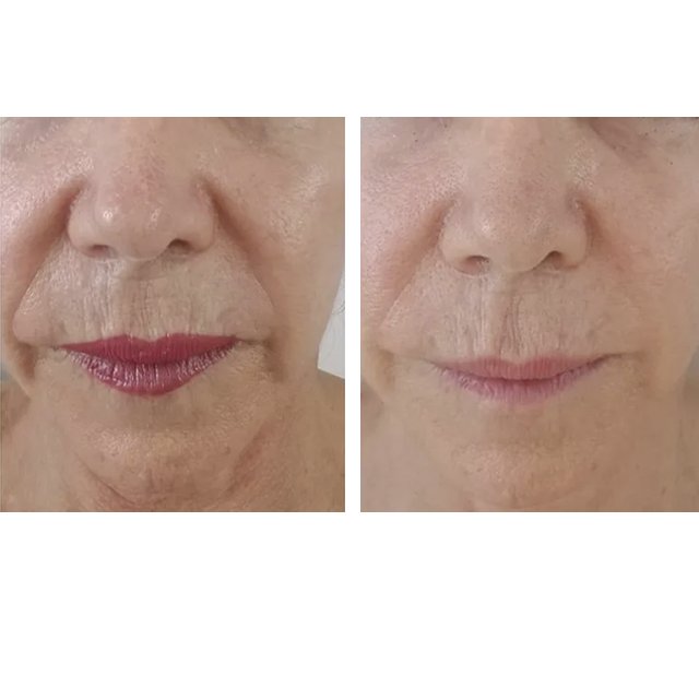 Penny Foskaris Wellness | Before & After Photos