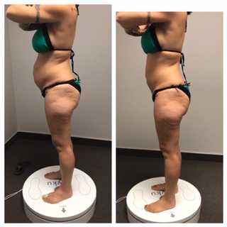Penny Foskaris Wellness | Before & After Photos