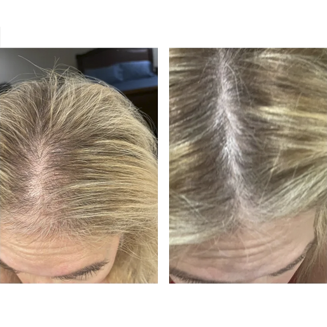 Penny Foskaris Wellness | Before & After Photos